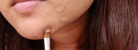 Can makeup cause acne? Here’s everything you need to know