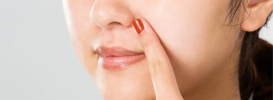 Should you squeeze blackheads? Here’s your complete guide